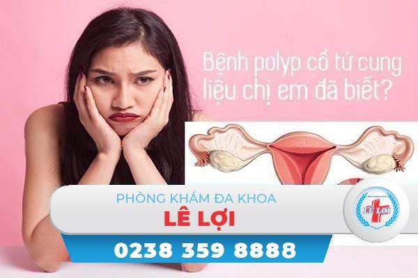 Biểu hiện nhận biết bệnh Polyp tử cung là gì và hỗ trợ điều trị