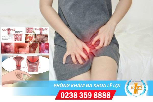 Các bệnh phụ khoa thường gặp ở nữ giới