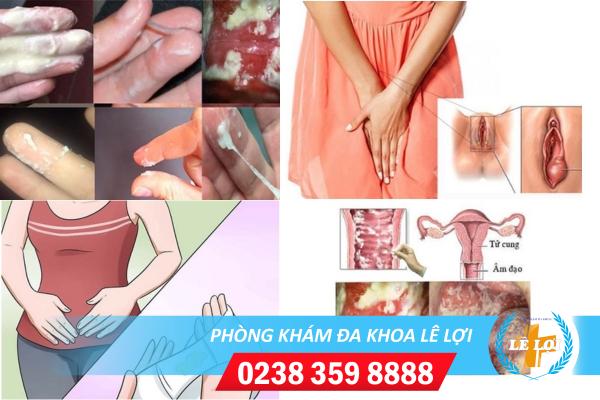 Dấu hiệu nhận biết bệnh phụ khoa