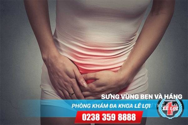 Nổi ám ảnh mang tên sưng vùng bẹn và háng