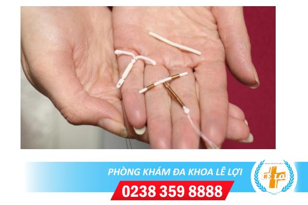 Đặt vòng tránh thai và những điều cần lưu ý