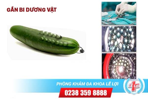 Gắn bi dương vật cải thiện kích thước