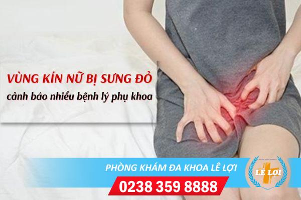 Hiện tượng vùng kín nữ bị sưng đỏ là dấu hiệu gì?