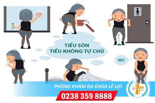 Hiện tượng són tiểu – Những cảnh báo cho nữ giới