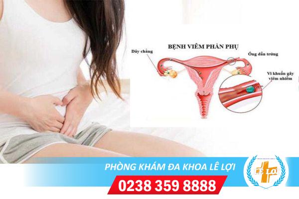 Viêm phần phụ là gì? Những dấu hiệu dễ nhận biết