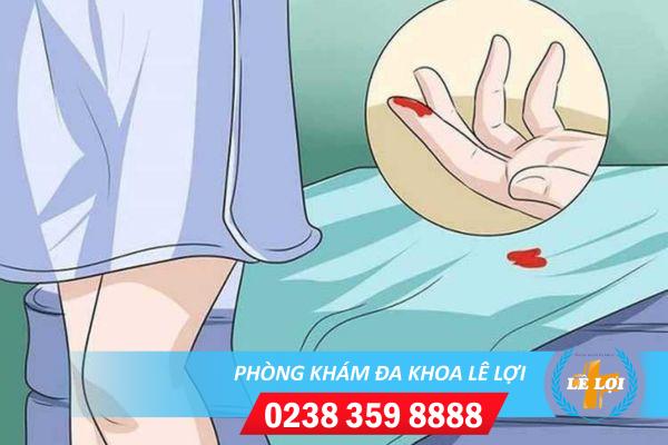 Âm đạo chảy máu bất thường là bị bệnh gì?