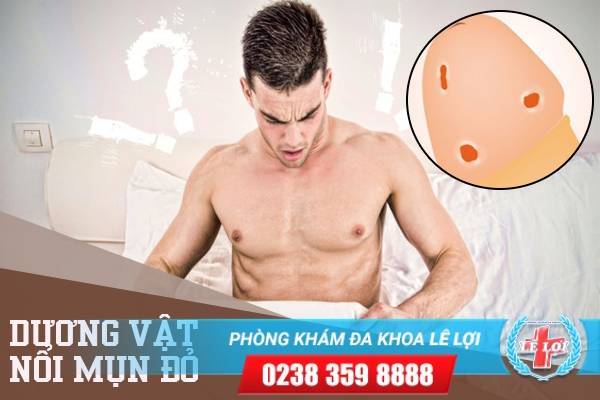 Dương vật nổi mụn đỏ là bị bệnh gì? Cách chữa trị như thế nào hiệu quả?