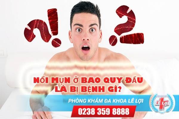 Nổi mụn ở bao quy đầu là bị bệnh gì?