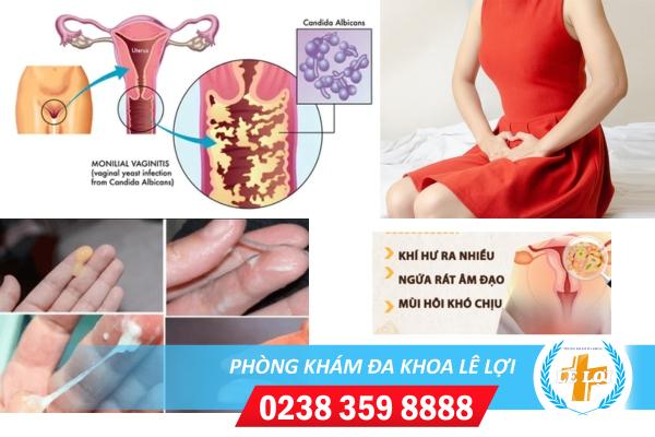 Bệnh viêm phụ khoa có nguy hiểm không?