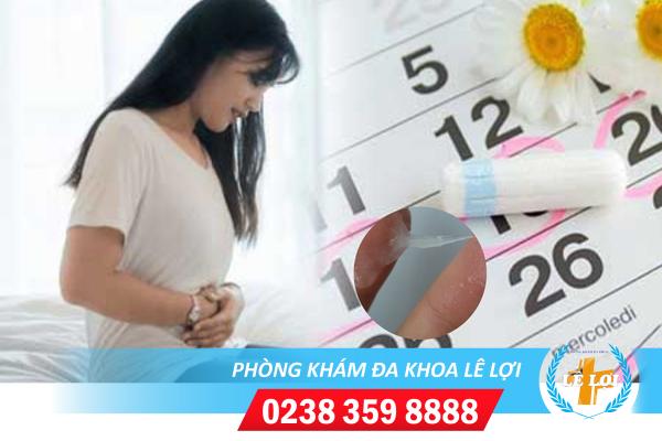 Bị chậm kinh ra nhiều khí hư là dấu hiệu bệnh gì?