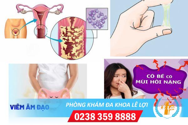 Tại sao lại bị viêm âm đạo – hậu quả của viêm âm đạo