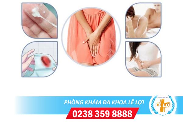 Dấu Hiệu Nhận Biết Viêm Phụ Khoa