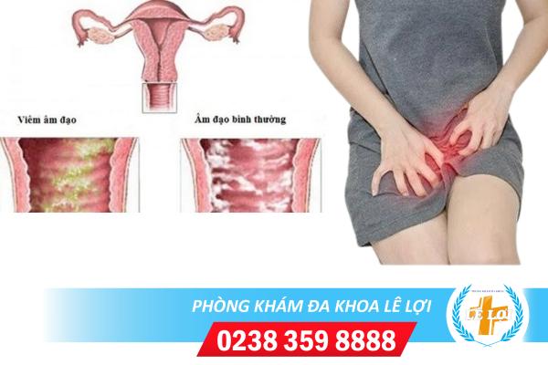 Dấu hiệu nhận biết bị viêm âm đạo