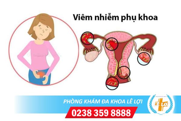 Cách phòng chống viêm nhiễm phụ khoa hiệu quả