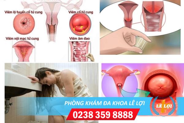 Biểu hiện viêm nhiễm phụ khoa nặng ở nữ