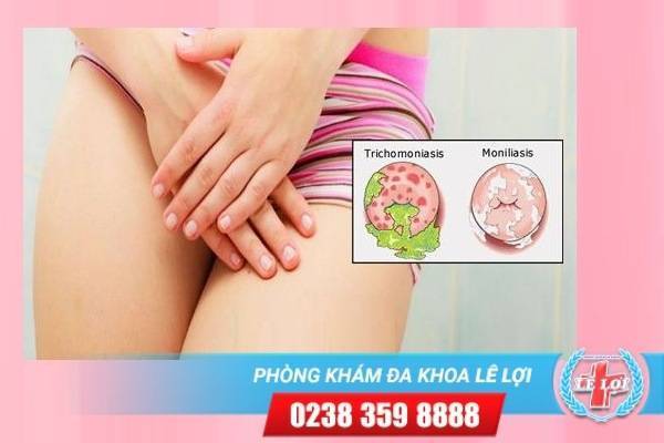 Khám chữa viêm âm đạo ở đâu hiệu quả – chi phí hợp lý tại Lê Lợi