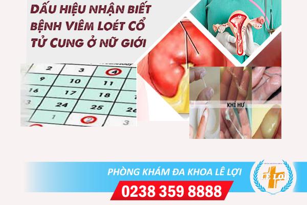 Dấu hiệu viêm loét cổ tử cung và cách điều trị hiệu quả