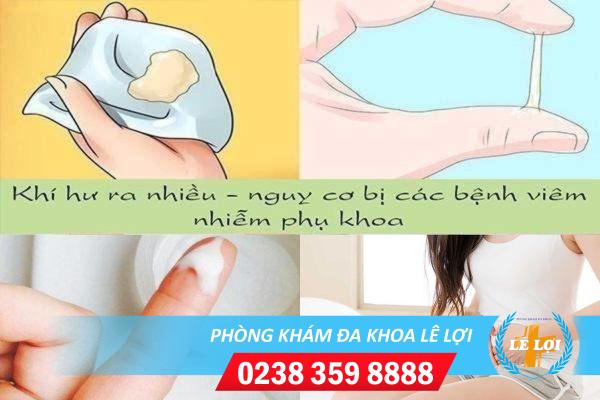 Hỗ trợ điều trị khí hư ra nhiều ở đâu tốt tại Nghệ An?