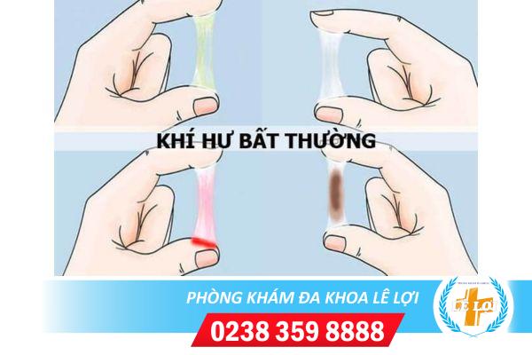 Khí hư bất thường sẽ nguy hiểm như thế nào đối với cho sức khỏe nữ giới