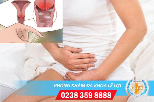 Nấm trắng ở vùng kín là bị gì?