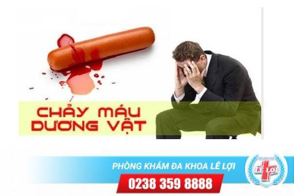 Tại sao nam giới lại bị dương vật chảy máu?