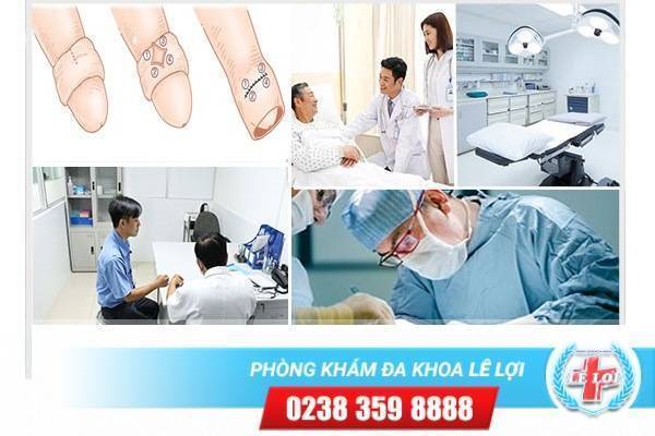 Thủ thuật cắt bao quy đầu không đau tại Đa Khoa Lê Lợi