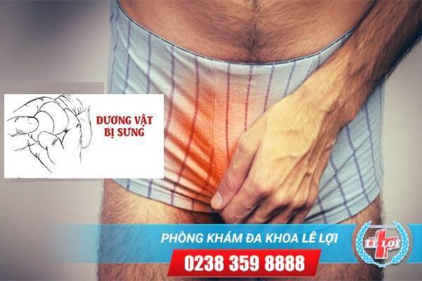 Bạn có biết bị sưng dương vật là bệnh gì và phương pháp xử lý