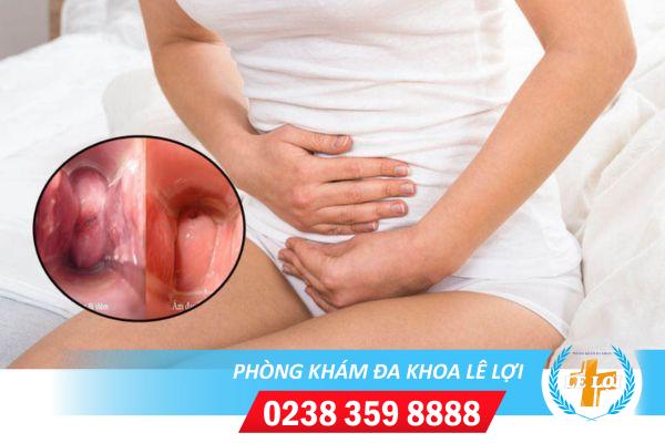 Viêm âm đạo có hiện tượng gì?