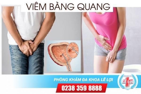 Bệnh viêm bàng quang và những kiến thức cần biết