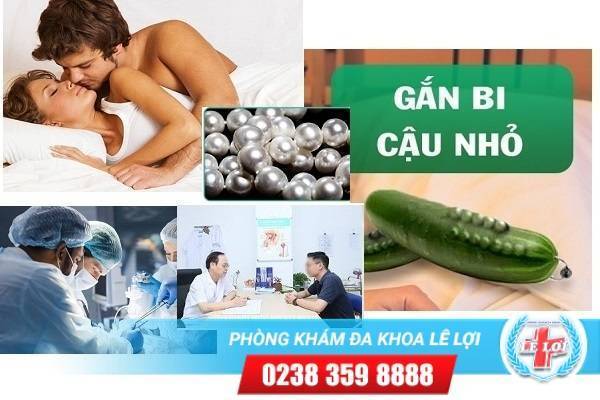 Phương pháp gắn bi dương vật tiên tiến tại Phòng khám Lê Lợi