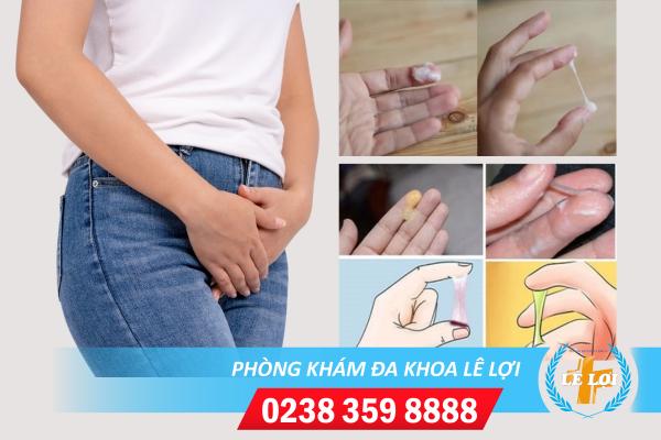 Bệnh huyết trắng là bệnh gì dấu hiệu nhận biết