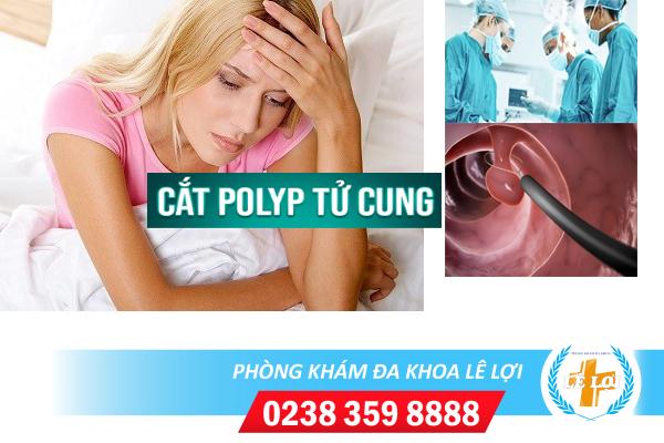 Cắt polyp cổ tử cung có hiệu quả và an toàn không?