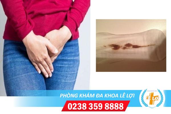 Chảy máu màu nâu là bị bệnh gì?