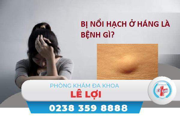 Nổi hạch ở háng là bị bệnh gì?