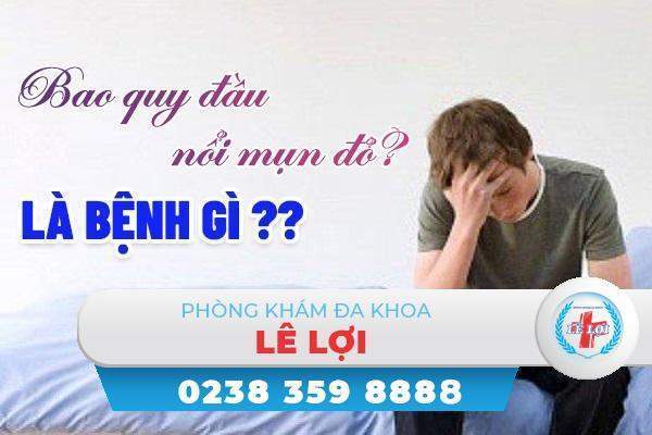 Bao quy đầu nổi mụn đỏ là bị bệnh gì?