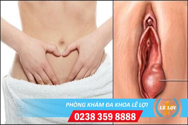 Mách bạn cách chữa sưng âm đạo vùng kín hiệu quả