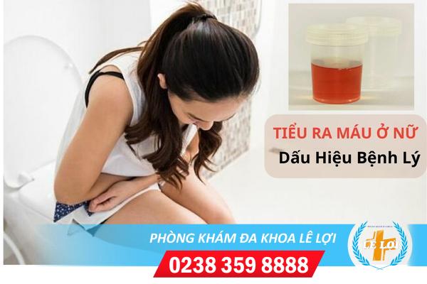 Tiểu ra máu ở nữ là bị bệnh gì?