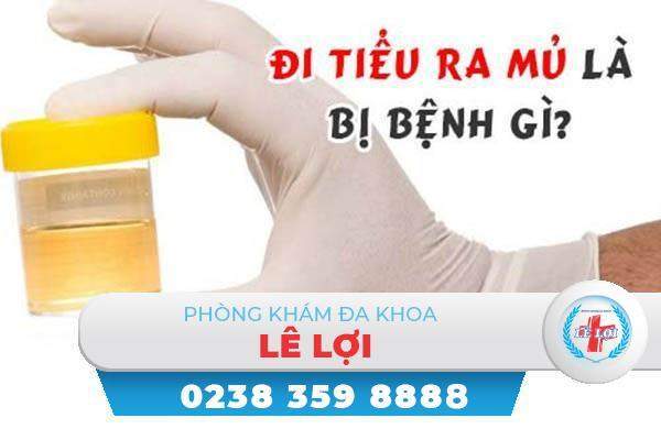 Tiểu ra mủ là bệnh gì nguy hiểm không?