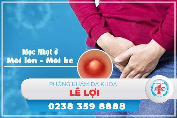 Hiện tượng mọc nhọt ở môi lớn, môi bé là bệnh gì?