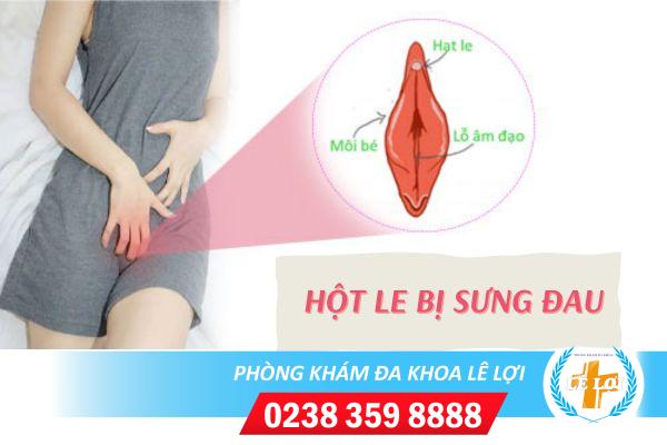 Hột le bị sưng đau và những điều cần biết