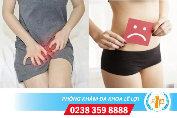 Cách điều trị ngứa mồng đốc hiệu quả