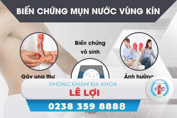 Những thông tin cần biết về mụn nước ở vùng kín