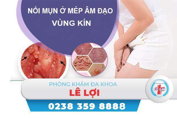 Nổi mụn ở mép âm đạo vùng kín là bị gì?