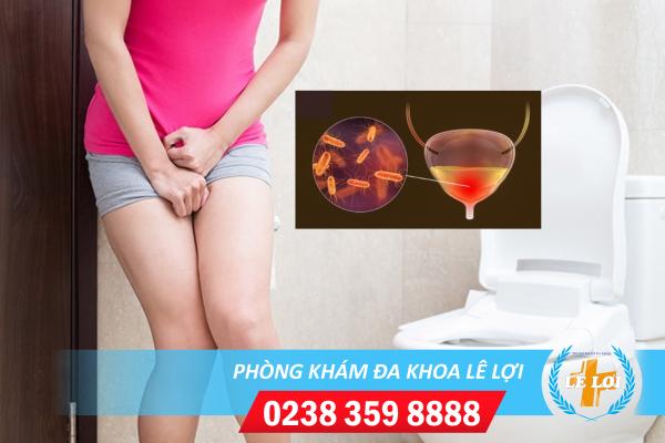 Cách chữa viêm bàng quang tại nhà hiệu quả