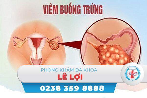 Viêm buồng trứng ở nữ giới