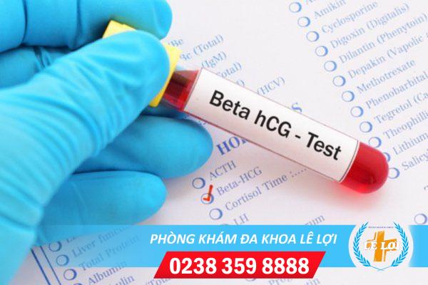 Xét nghiệm beta HCG là gì? Các vấn đề cần lưu ý khi thực hiện xét nghiệm