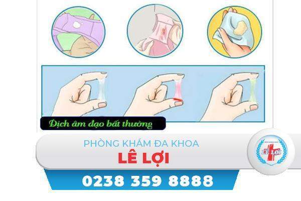 Âm đạo ra dịch bất thường là bị bệnh gì?