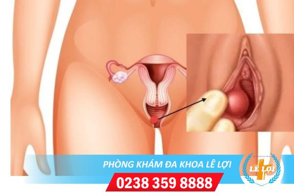 Bộ phận sinh dục nữ bị sưng do đâu và cách điều trị