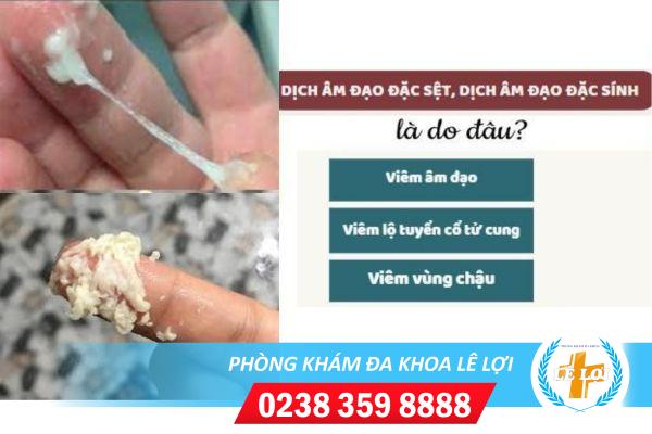 Dịch âm đạo đặc sệt, dịch âm đạo đặc dính cảnh báo điều gì?