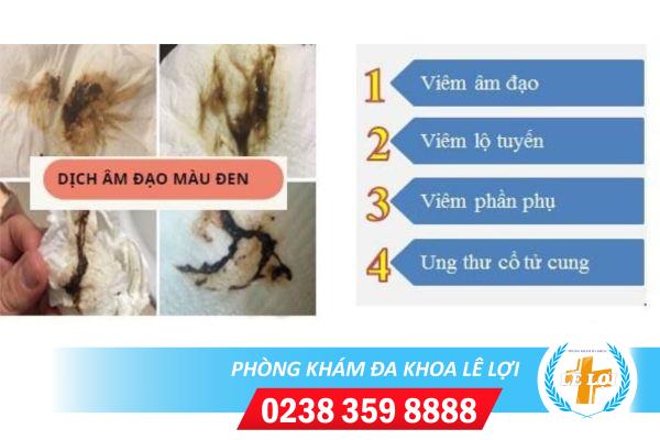 Dịch âm đạo màu đen nguy hiểm không?